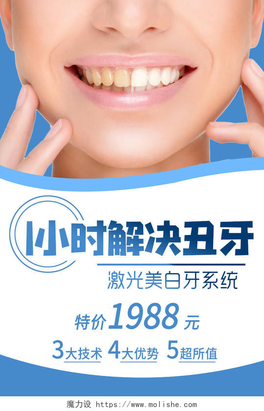 简约大气牙齿美白美白牙齿宣传海报牙齿美白海报